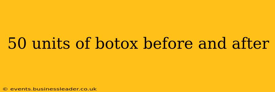 50 units of botox before and after