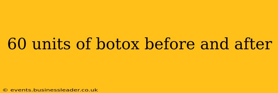 60 units of botox before and after