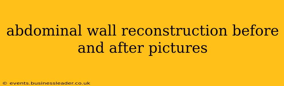 abdominal wall reconstruction before and after pictures
