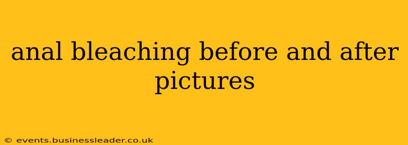anal bleaching before and after pictures