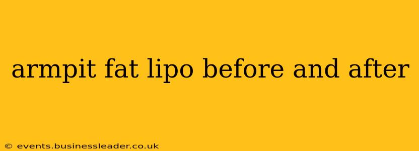 armpit fat lipo before and after