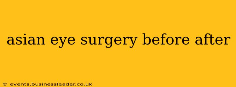 asian eye surgery before after