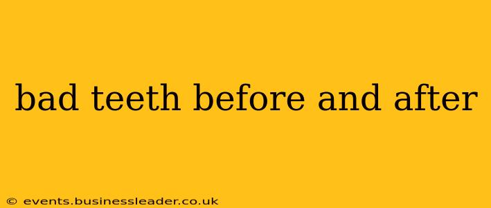 bad teeth before and after