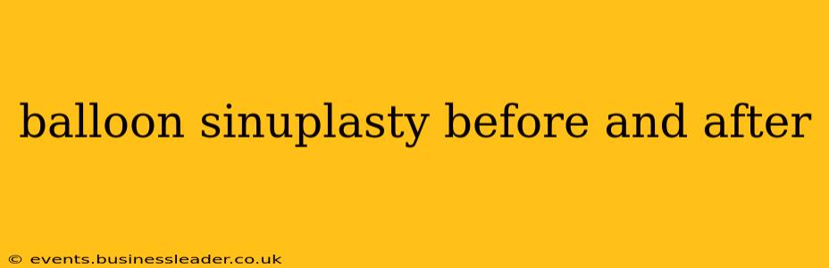 balloon sinuplasty before and after