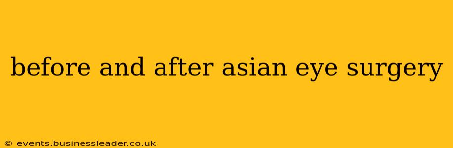 before and after asian eye surgery