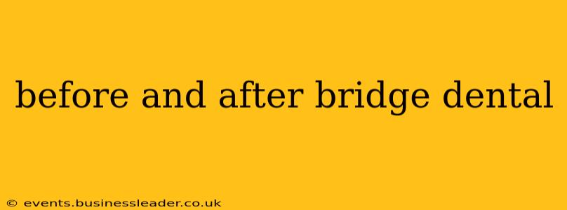 before and after bridge dental