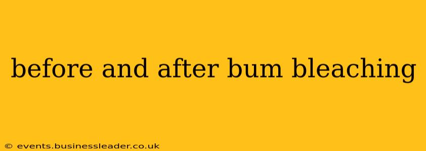before and after bum bleaching
