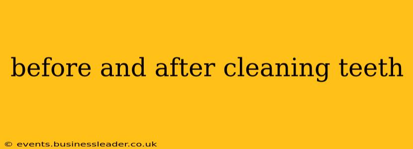 before and after cleaning teeth