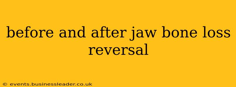 before and after jaw bone loss reversal