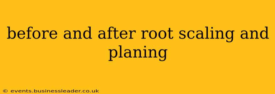 before and after root scaling and planing