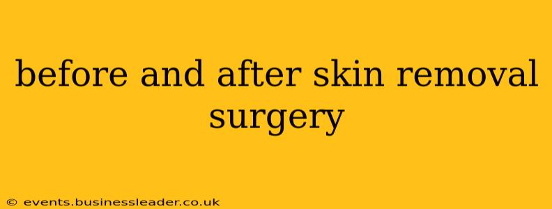 before and after skin removal surgery