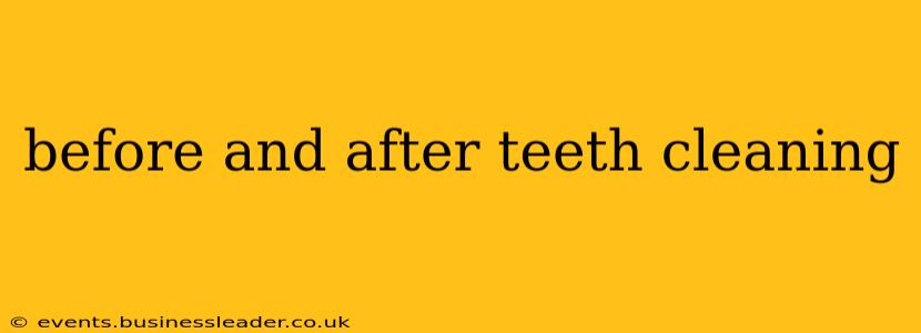 before and after teeth cleaning