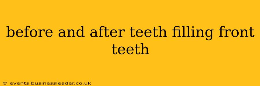 before and after teeth filling front teeth