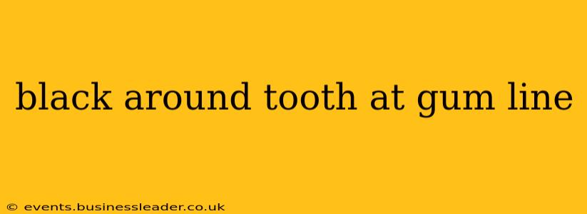 black around tooth at gum line