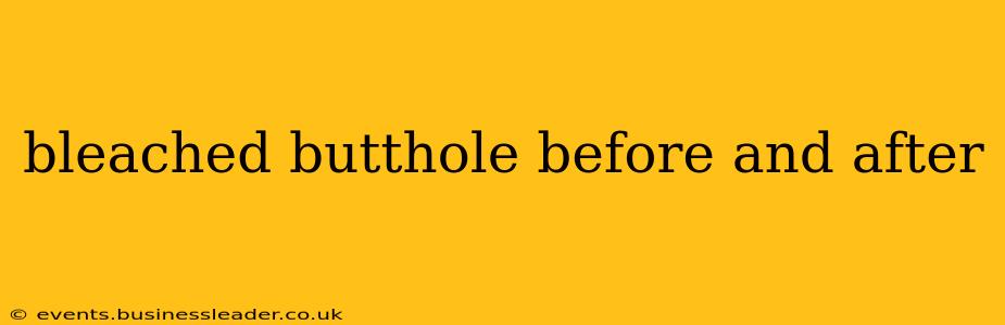 bleached butthole before and after