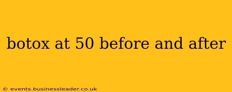 botox at 50 before and after