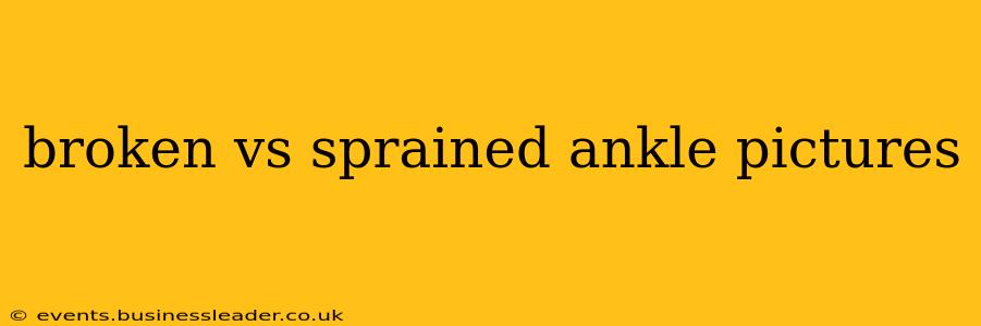 broken vs sprained ankle pictures