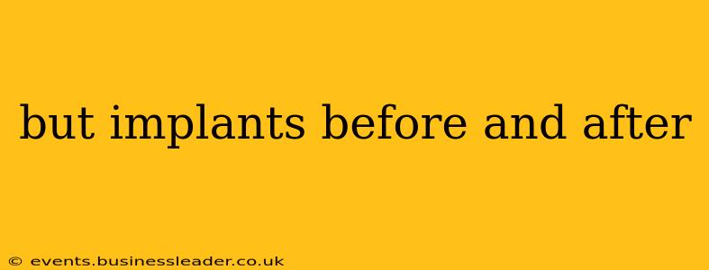 but implants before and after