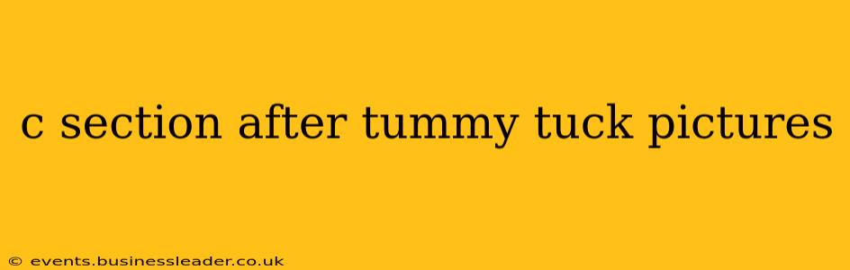 c section after tummy tuck pictures