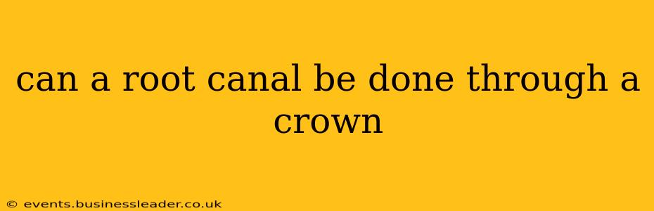 can a root canal be done through a crown