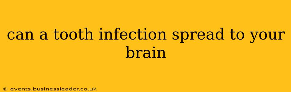 can a tooth infection spread to your brain