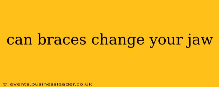 can braces change your jaw