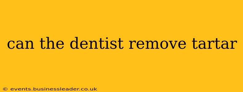 can the dentist remove tartar
