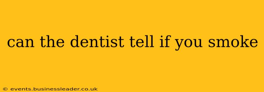can the dentist tell if you smoke