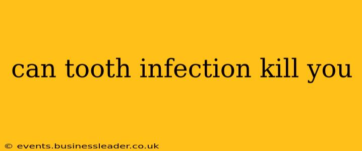 can tooth infection kill you