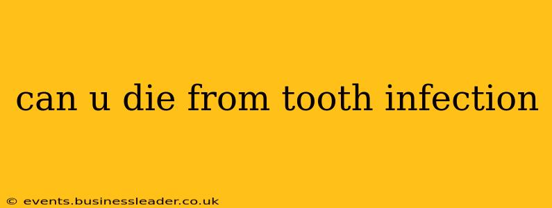 can u die from tooth infection