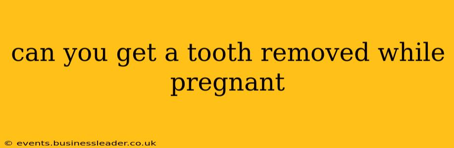 can you get a tooth removed while pregnant