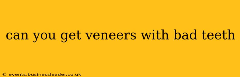 can you get veneers with bad teeth