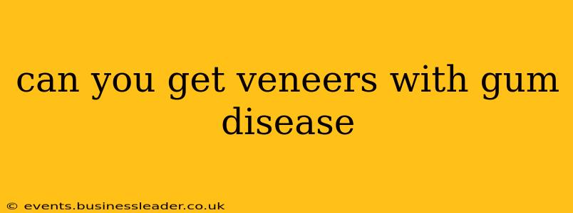 can you get veneers with gum disease