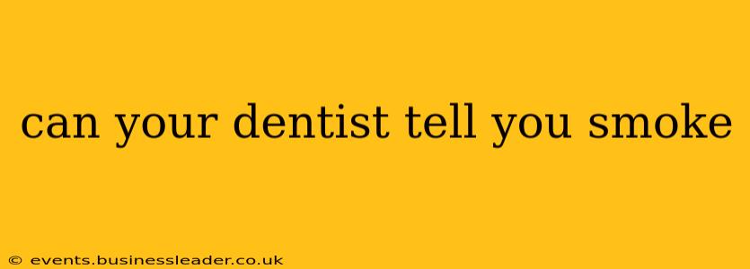 can your dentist tell you smoke