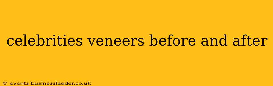 celebrities veneers before and after