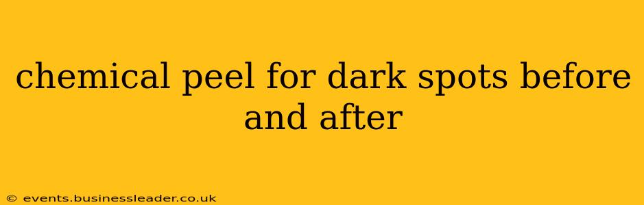 chemical peel for dark spots before and after