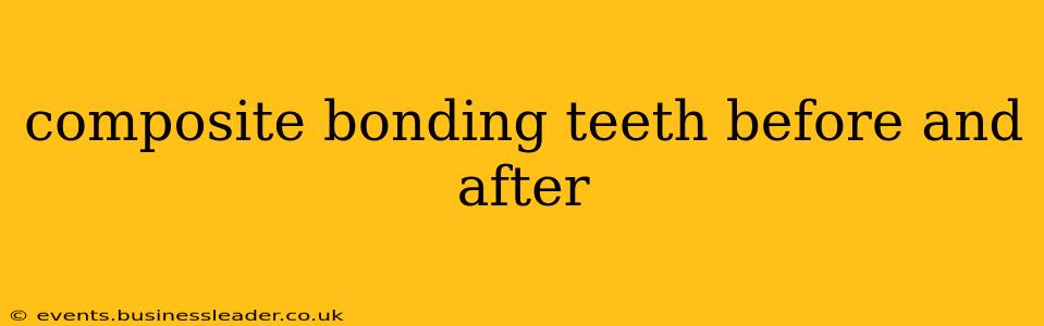 composite bonding teeth before and after