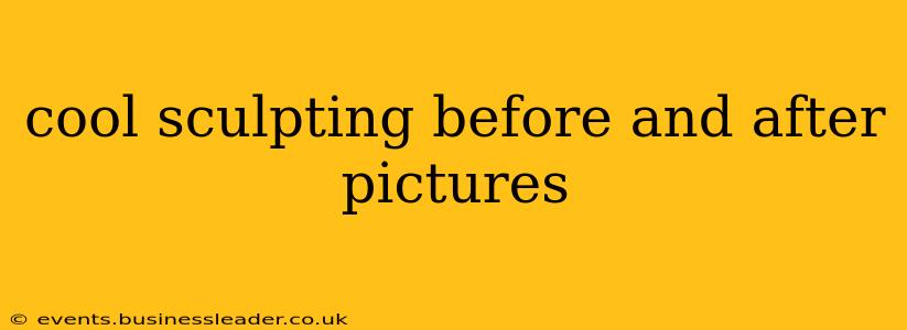 cool sculpting before and after pictures