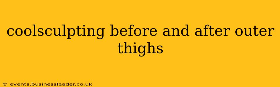 coolsculpting before and after outer thighs