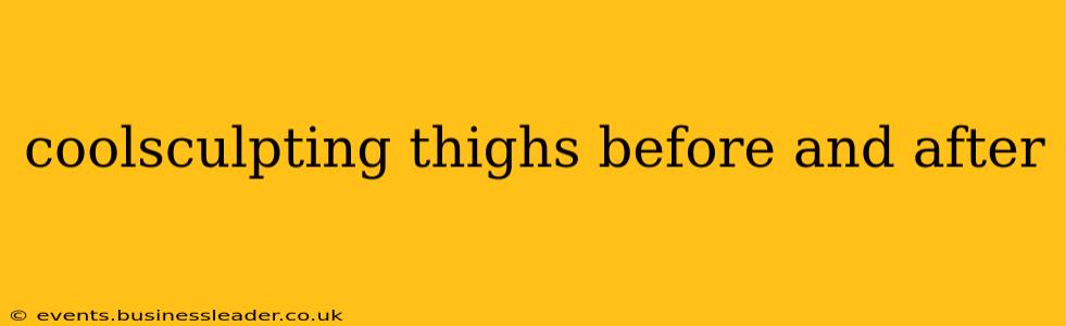 coolsculpting thighs before and after