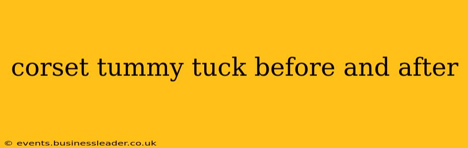 corset tummy tuck before and after