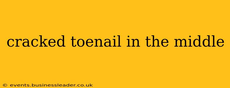 cracked toenail in the middle