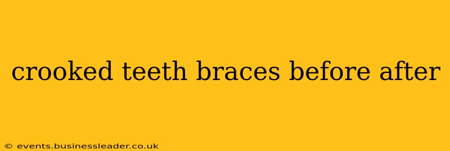 crooked teeth braces before after