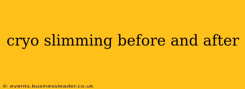 cryo slimming before and after