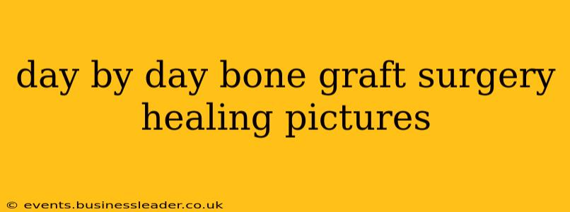 day by day bone graft surgery healing pictures
