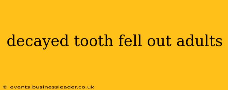 decayed tooth fell out adults