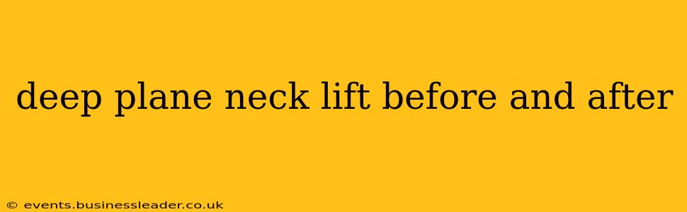deep plane neck lift before and after