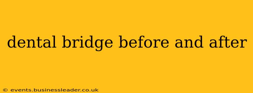 dental bridge before and after