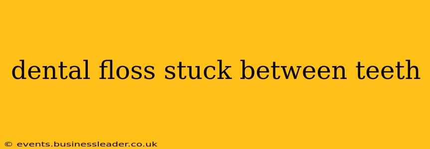 dental floss stuck between teeth