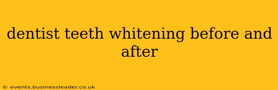 dentist teeth whitening before and after